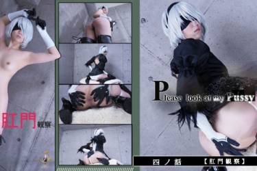 ---Ladies Collection--- 四ノ話　「肛門観察」